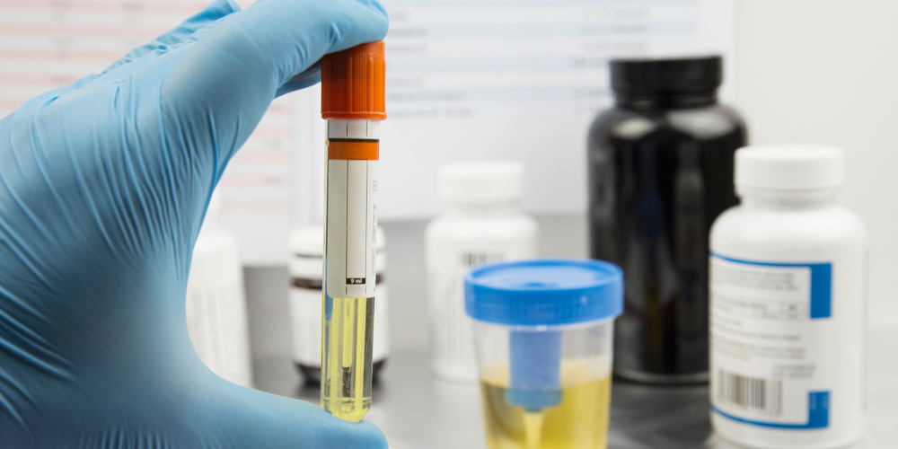 Dried Urine Test for Comprehensive Hormones (DUTCH)